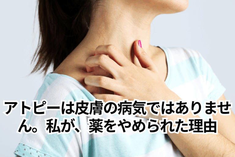 アトピーは皮膚の病気ではありません。私が、薬をやめられた理由